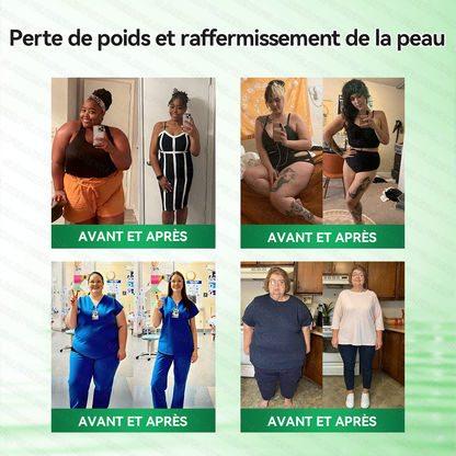 Boutique Officielle 🇫🇷 | Patch Minceur Solaroza® 10-en-1 : Relancez le Métabolisme et Brûlez les Graisses (NAD+ & Berbérine)