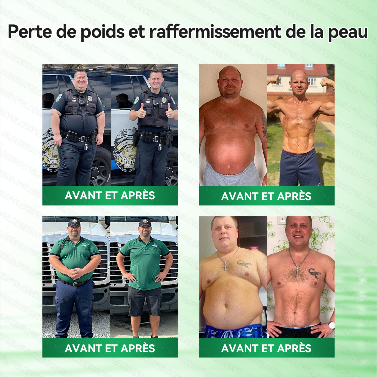 Boutique Officielle 🇫🇷 | Patch Minceur Solaroza® 10-en-1 : Relancez le Métabolisme et Brûlez les Graisses (NAD+ & Berbérine)