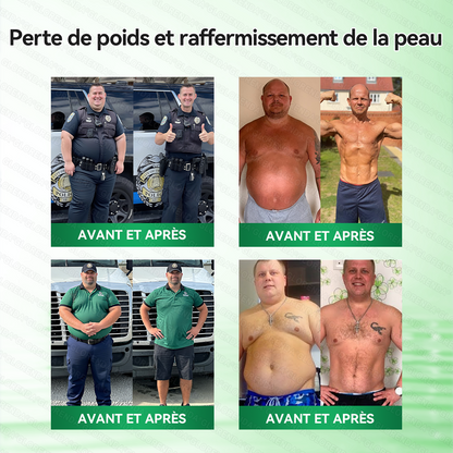 Boutique Officielle 🇫🇷 | Patch Minceur Solaroza® 10-en-1 : Relancez le Métabolisme et Brûlez les Graisses (NAD+ & Berbérine)